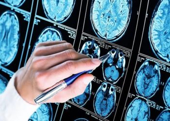 Un paciente en Reino Unido es el primero en el mundo operado del cerebro con apoyo de inteligencia artificial en tiempo real