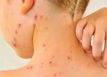 OPS emite una alerta epidemiológica para incrementar la vacunación ante el brote de sarampión en América